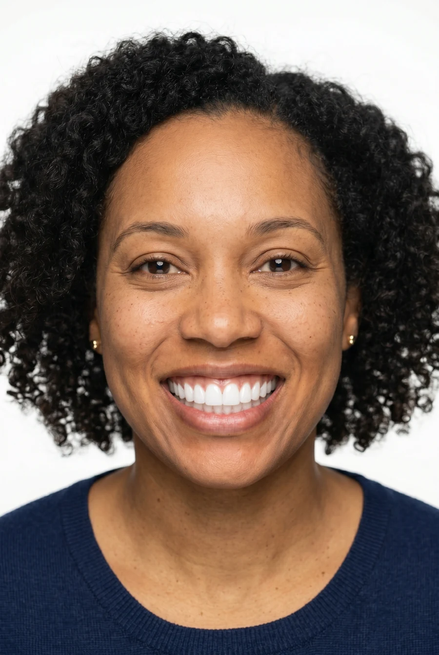 After — with porcelain veneers